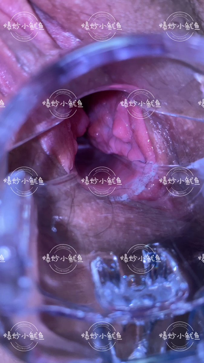 或许应该叫做扩阴